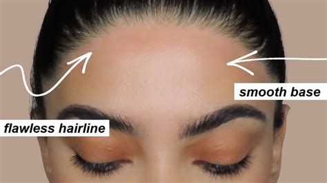 Magic Easy Hairline Fixes: A Game-Changer in the Hair Industry